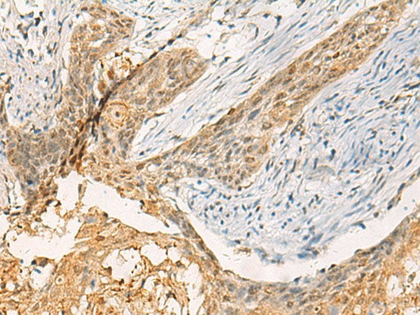 TBCK Polyclonal Antibody Reactivity Human