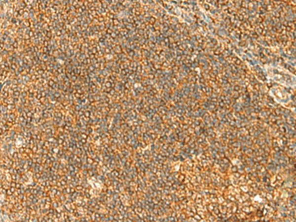 TBCK Polyclonal Antibody Reactivity Human