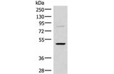 RRP8 Polyclonal Antibody Host Rabbit