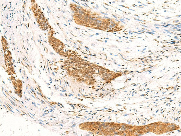 IDUA Polyclonal Antibody Reactivity Human