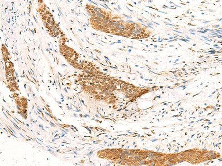 IDUA Polyclonal Antibody Reactivity Human