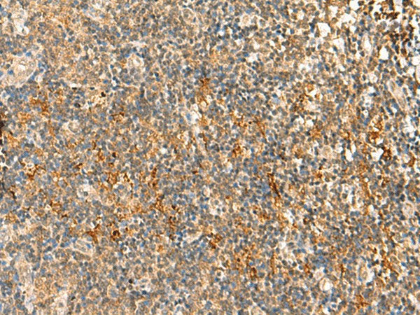 HTT Polyclonal Antibody Reactivity Human