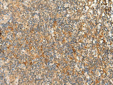 HTT Polyclonal Antibody Reactivity Human