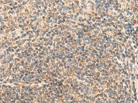 IDUA Polyclonal Antibody Reactivity Human