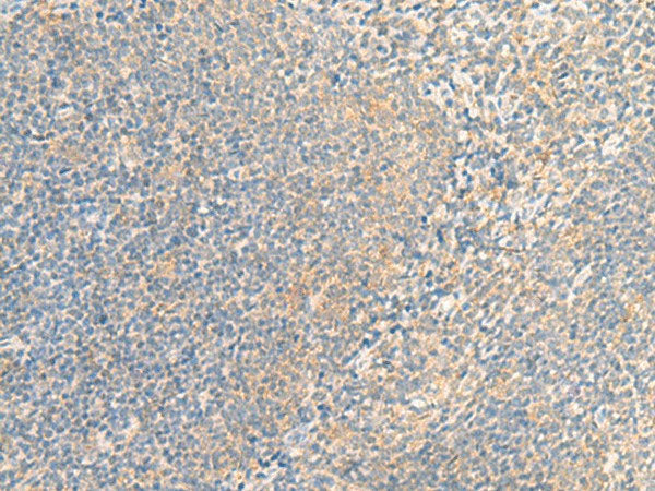 IFNA5 Polyclonal Antibody Reactivity Human
