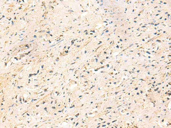 IP6K3 Polyclonal Antibody Reactivity Human