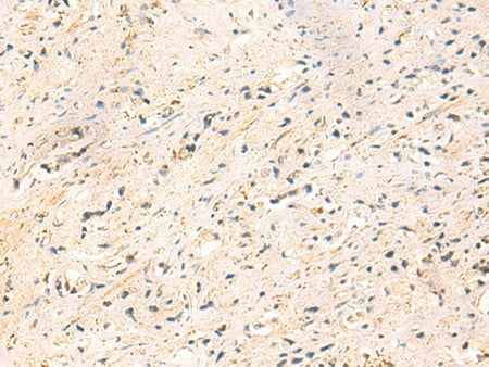 IP6K3 Polyclonal Antibody Reactivity Human