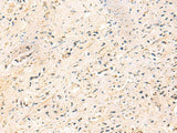 IP6K3 Polyclonal Antibody Reactivity Human