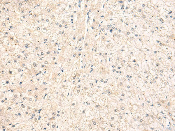 ELP1 Polyclonal Antibody