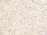 ELP1 Polyclonal Antibody