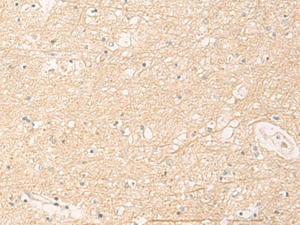 ELP1 Polyclonal Antibody