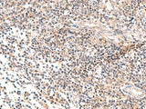 IL36B Polyclonal Antibody
