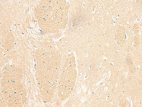 IL37 Polyclonal Antibody Reactivity Human