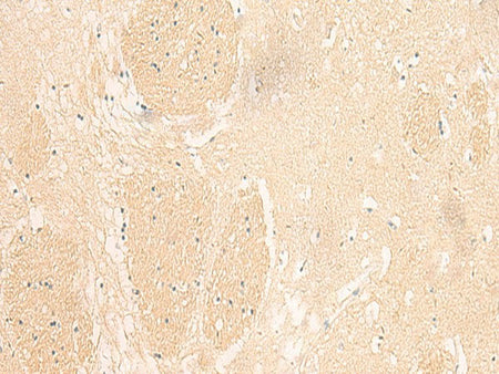 IL37 Polyclonal Antibody Reactivity Human