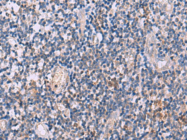 IL4R Polyclonal Antibody Reactivity Human
