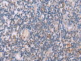 IL4R Polyclonal Antibody Reactivity Human