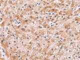 IL4R Polyclonal Antibody Reactivity Human
