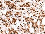 FOXK2 Polyclonal Antibody Host Rabbit