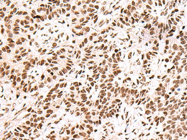 FOXK2 Polyclonal Antibody Host Rabbit