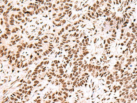 FOXK2 Polyclonal Antibody Host Rabbit
