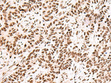 FOXK2 Polyclonal Antibody Host Rabbit
