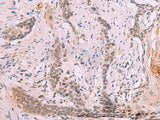 INO80 Polyclonal Antibody Host Rabbit