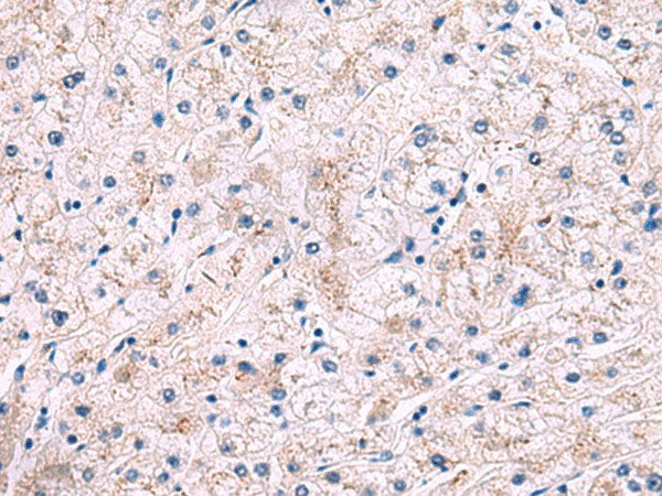 IP6K2 Polyclonal Antibody Reactivity Rat