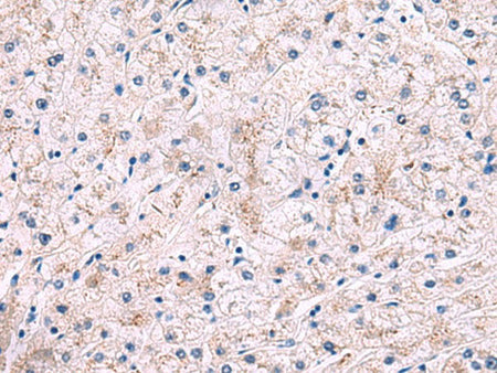 IP6K2 Polyclonal Antibody Reactivity Rat