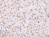 IP6K2 Polyclonal Antibody Reactivity Rat