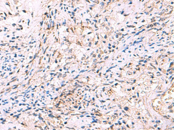 INPP5B Polyclonal Antibody Host Rabbit