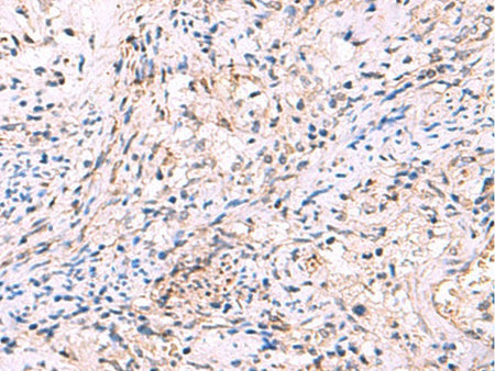 INPP5B Polyclonal Antibody Host Rabbit