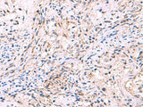 INPP5B Polyclonal Antibody Host Rabbit