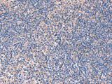 INPP5B Polyclonal Antibody Host Rabbit