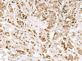 INSM1 Polyclonal Antibody Host Rabbit