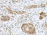 INSM1 Polyclonal Antibody Host Rabbit