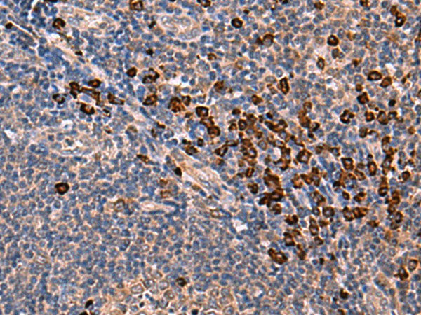 INSM2 Polyclonal Antibody Host Rabbit