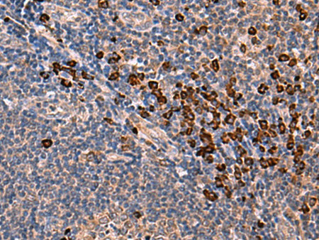 INSM2 Polyclonal Antibody Host Rabbit