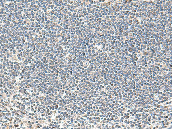 IFNA2 Polyclonal Antibody Host Rabbit