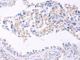 GRIA2 Polyclonal Antibody Host Rabbit