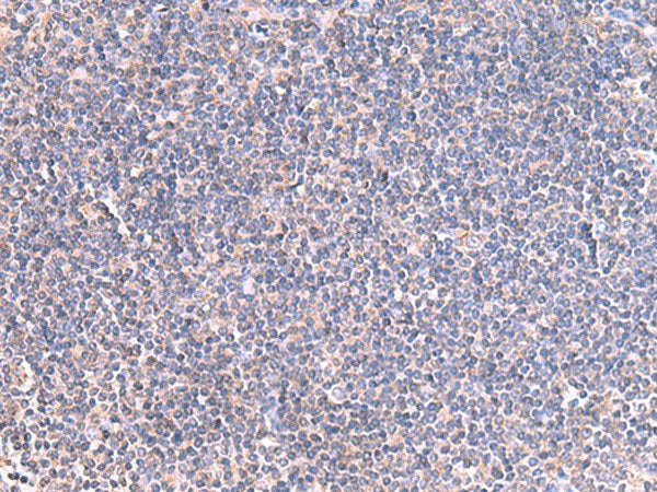 GRIA2 Polyclonal Antibody Host Rabbit