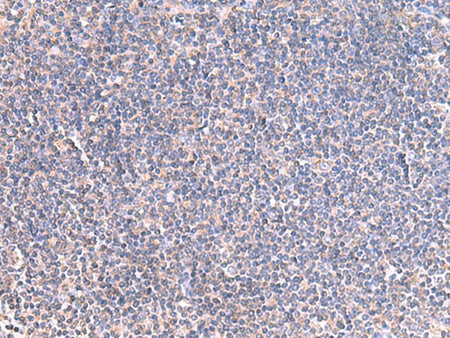 GRIA2 Polyclonal Antibody Host Rabbit