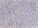 GRIA2 Polyclonal Antibody Host Rabbit