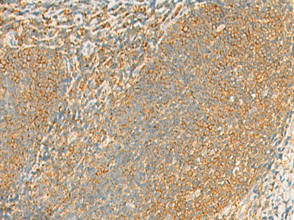 GRIA4 Polyclonal Antibody Host Rabbit
