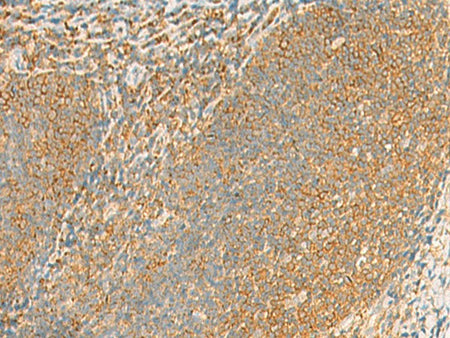 GRIA4 Polyclonal Antibody Host Rabbit
