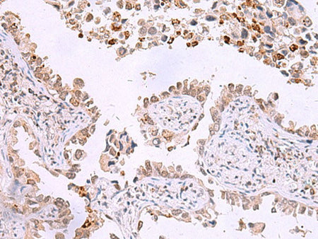 ITPKC Polyclonal Antibody Reactivity Human