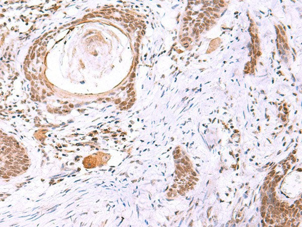 ITPKC Polyclonal Antibody Reactivity Human