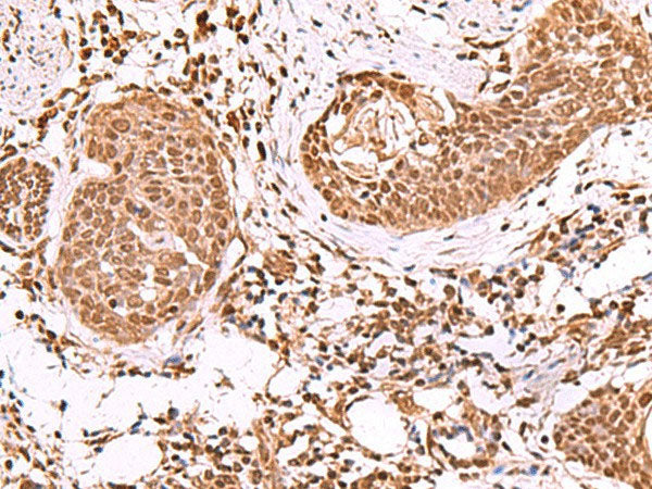 IP6K1 Polyclonal Antibody Reactivity Rat