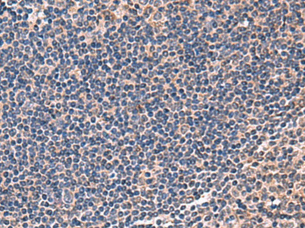 IPPK Polyclonal Antibody Reactivity Rat