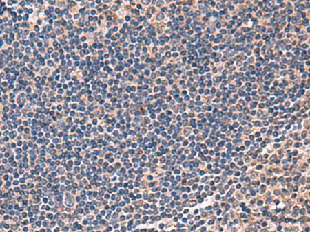 IPPK Polyclonal Antibody Reactivity Rat