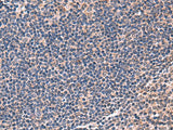 IPPK Polyclonal Antibody Reactivity Rat